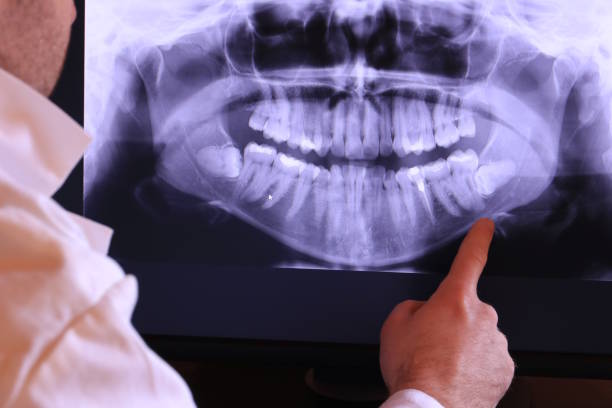 Best Emergency Treatment for Toothache in Kincheloe, MI