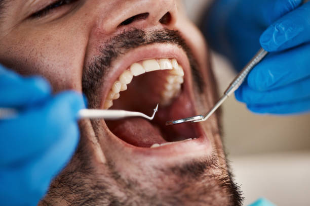 Best Emergency Treatment for Toothache in Kincheloe, MI